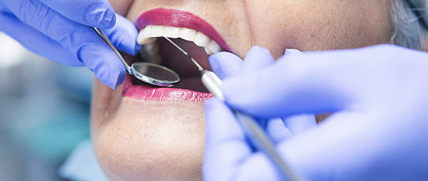 Best Emergency Treatment for Dental Infections or Abscesses in Steiner Ranch, TX